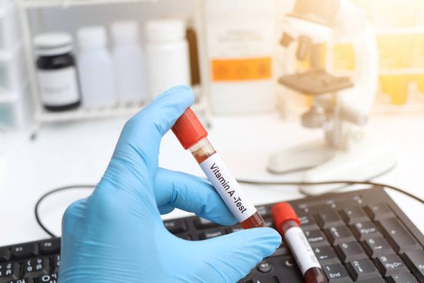 Verinäytteet A-vitamiinin testaamiseksi laboratoriossa, verinäyte koeputkessa - Valokuva, kuva