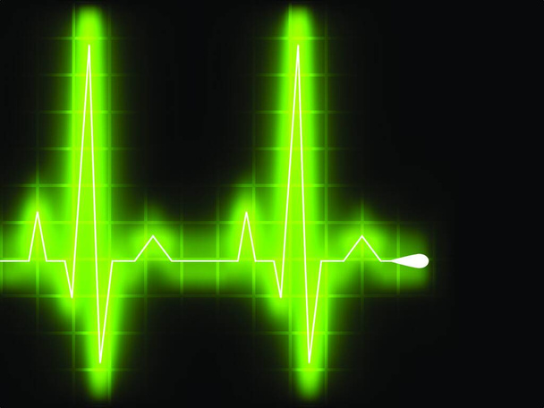 "πράσινη καρδιά κτύπησε. γράφημα ΗΚΓ. EPS 8" - Διάνυσμα, εικόνα