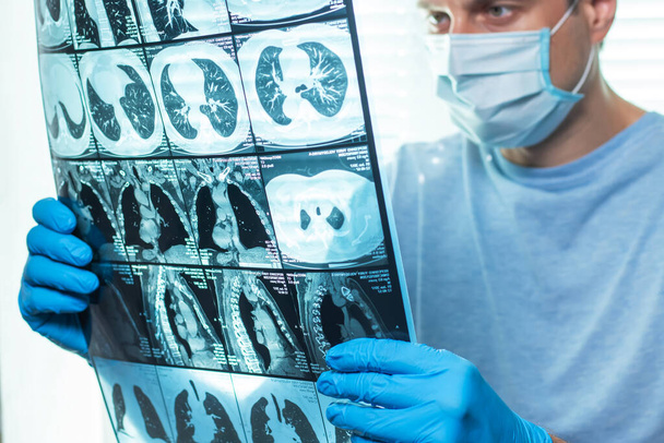 Врач внимательно изучает МРТ пациента
 - Фото, изображение