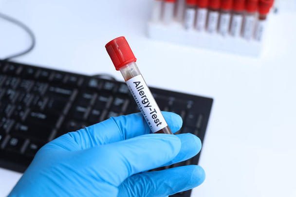 Test d'allergie pour rechercher des anomalies du sang, échantillon de sang à analyser en laboratoire, sang dans une éprouvette - Photo, image