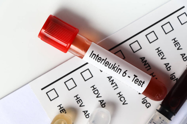 Интерлейкин-6 тест на выявление аномалий крови, образец крови для анализа в лаборатории, кровь в пробирке - Фото, изображение