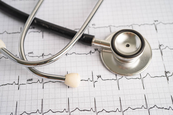 Stetoscopio su elettrocardiogramma ECG, onda cardiaca, infarto, cardiogramma. - Foto, immagini