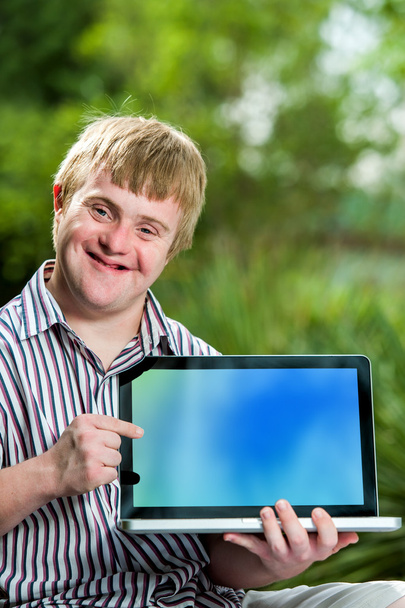 Menino deficiente apontando para a tela do laptop em branco
. - Foto, Imagem