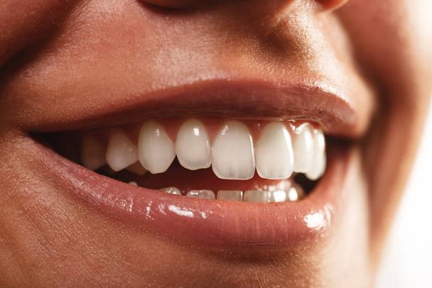 Close up of a girls mouth and teeth at the studio smiling - Photo, Image