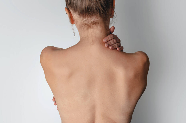 Neck pain. Woman hold mussles. - Photo, Image