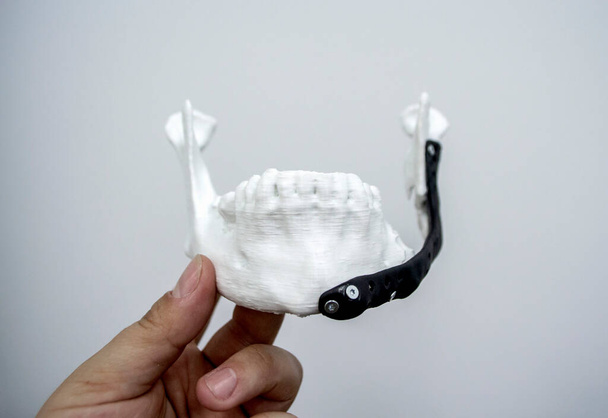 手で保持する人3Dプリントプラスチックプロトタイプ人間の下顎と医療チタンインプラントクローズアップ。金属粉末から印刷された義肢の解剖学的骨3D 。整形外科｜maxilloの顔のプロテーゼ - 写真・画像