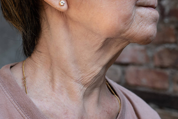 Güneydoğu Asyalı, Çinli yaşlı bir kadının boynundaki yaşlanan deri kıvrımları veya cilt kırışıklıkları veya kırışıklıkları. - Fotoğraf, Görsel