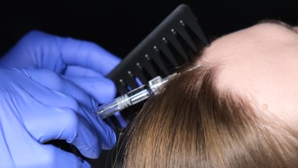 Un médecin trichologue injecte du plasma dans la tête. Une procédure pour la croissance des cheveux sur la tête. Problèmes de perte de cheveux - Séquence, vidéo