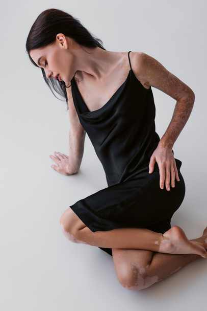 High angle view of sensual woman with vitiligo posing in dress on grey background  - Zdjęcie, obraz