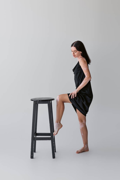 Pretty barefoot model with vitiligo standing near chair on grey background  - Foto, afbeelding