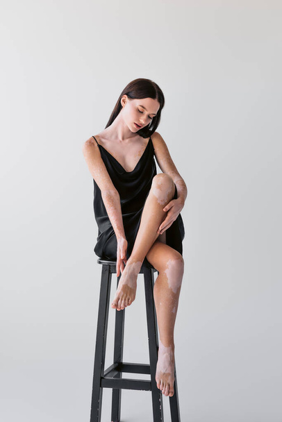 mooie vrouw met vitiligo aanraken blote voeten terwijl zitten op stoel op grijze achtergrond  - Foto, afbeelding