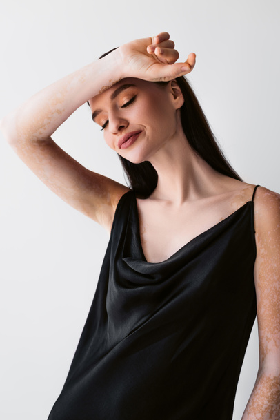 Красивая модель с витилиго позируя в черном шелковом платье изолированы на сером  - Фото, изображение