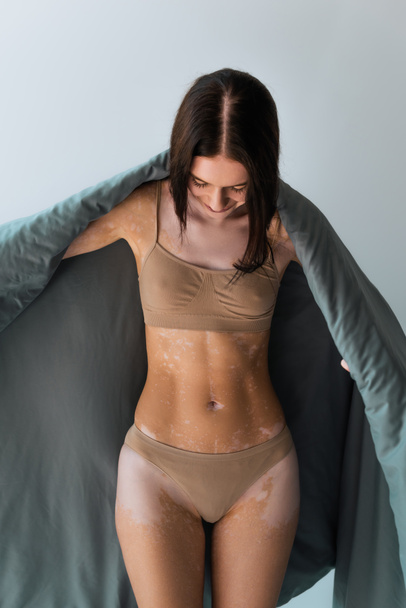 jeune femme avec état de peau vitiligo debout en sous-vêtements et couverture dans une couverture isolée sur gris  - Photo, image