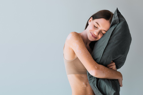 happy young woman with vitiligo standing in beige lingerie and hugging pillow isolated on grey isolated on grey  - Foto, immagini