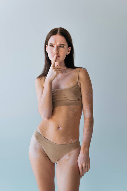 zamyšlená mladá žena s vitiligem myšlení a dotýkání rty s prstem izolované na šedé - Fotografie, Obrázek