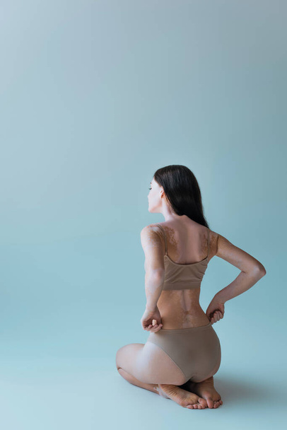 plná délka bosá a mladá žena s vitiligo sedí a upravuje béžové kalhotky na šedé - Fotografie, Obrázek