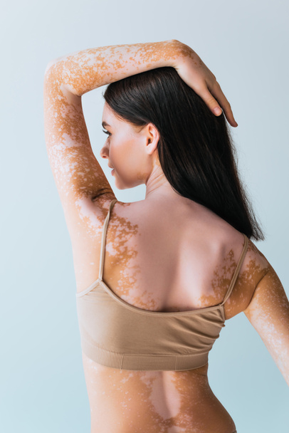 mladá žena s vitiligo dotýkat brunetky vlasy při pohledu pryč izolované na šedé  - Fotografie, Obrázek