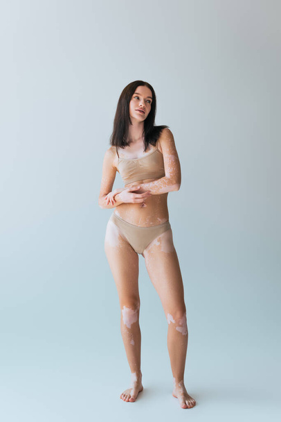 full length of brunette young woman with vitiligo posing in beige lingerie while looking away on grey - Zdjęcie, obraz