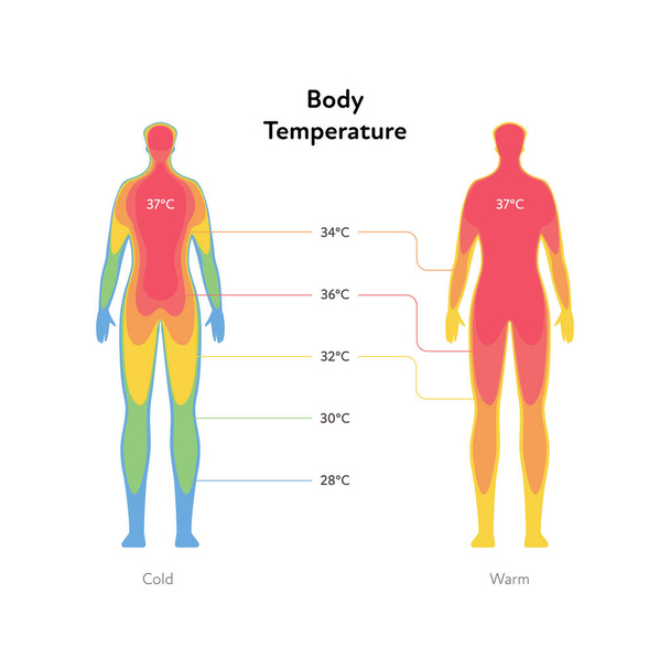 Hyperthermia és hipotermia az egészségügyben infografikával. Vektor lapos egészségügyi illusztráció. Test infravörös hőtérkép Celsius szimbólum elszigetelt fehér alapon. - Vektor, kép