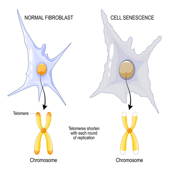 Chromosoom van een normaal fibroblast en celsenescentie. Telomeren verkorten met elke replicatieronde. verouderingsproces. Vector poster - Vector, afbeelding