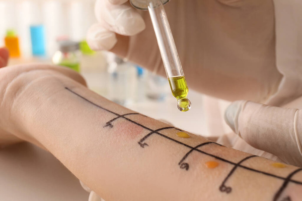 Lääkäri tekee allergia ihotesti potilaan käsi klinikalla, lähikuva - Valokuva, kuva
