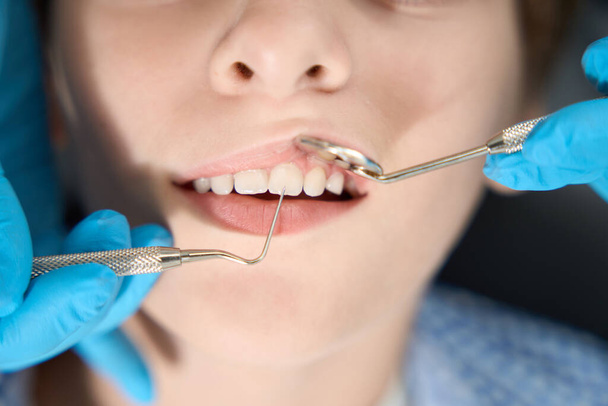Child on examination at the dentist in the dental office, the specialist uses special tools - 写真・画像