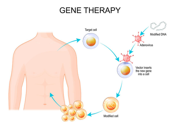 Ingeniería genética. Terapia génica usando un vector de adenovirus. virus inserta el nuevo gen en una célula, que producirá proteínas para tratar una enfermedad. ilustración vectorial - Vector, imagen