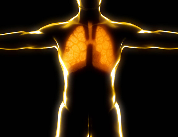 Ανθρώπινη ανατομία, προβλήματα με το αναπνευστικό σύστημα, σοβαρά κατεστραμμένοι πνεύμονες. Διμερής πνευμονία. Covid-19, ο κορωνοϊός. Ασθενής και καπνός. Καπνιστής. 3d απόδοση - Φωτογραφία, εικόνα