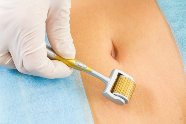 Injection mesotherapy on belly - Photo, Image