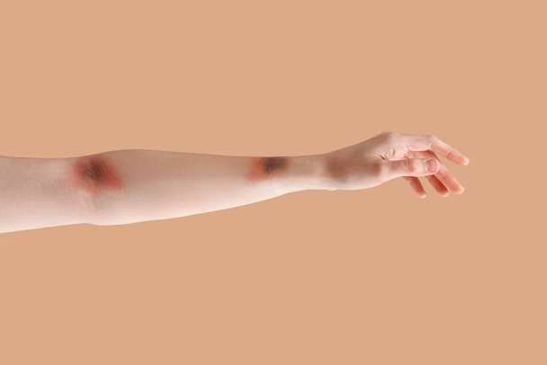 Zúzott női kéz bézs alapon - Fotó, kép