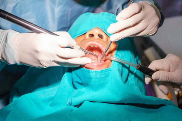 arts het reinigen van de tanden patiënt met ultrasoon gereedschap. Verwijdering van tandsteen en plaque, preventie van tandheelkundige aandoeningen paradontitis. - Foto, afbeelding
