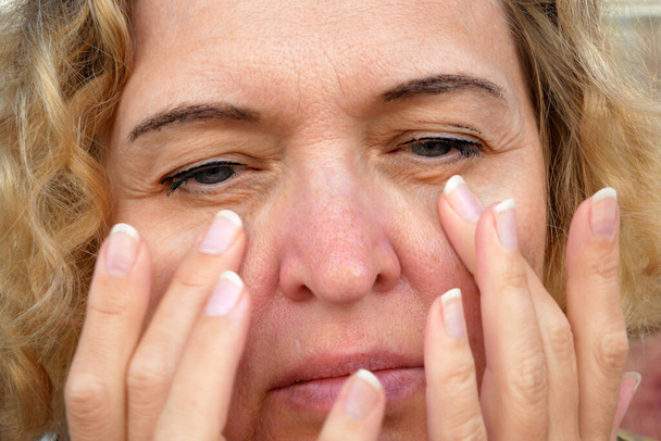 Oko samicy w średnim wieku z opadającą powieką robiącą masaż twarzy. Ptoza jest opadanie górnej powieki, leniwe oko. Kosmetologia i koncepcja twarzy, pierwsze zmarszczki, zbliżenie - Zdjęcie, obraz
