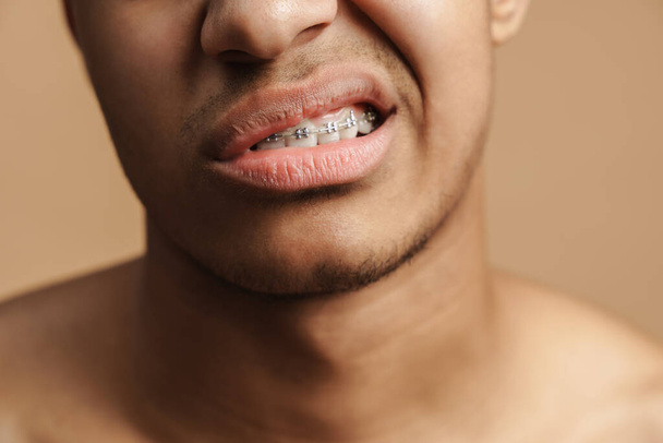 Νεαρός άνδρας με τρίχες που δείχνει το οδοντικό του στήριγμα στην κάμερα απομονωμένος πάνω από μπεζ φόντο - Φωτογραφία, εικόνα