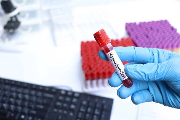 Test de magnésium pour rechercher des anomalies du sang, échantillon de sang à analyser en laboratoire, sang dans une éprouvette - Photo, image
