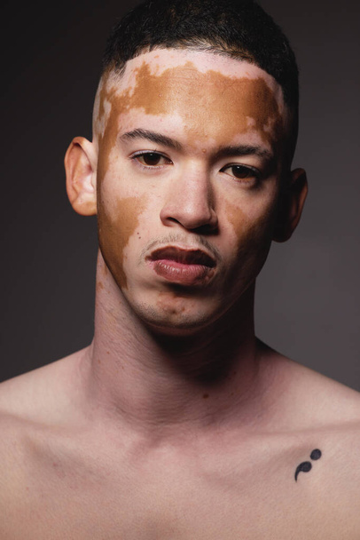 Vitiligo, skincare and portrait of black man with beauty, wellness face and luxury cosmetic against dark black studio background. Healthy body, facial dermatology and African model with care of skin. - Valokuva, kuva