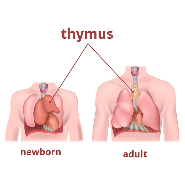 Die Thymusdrüse des Erwachsenen und Neugeborenen. Vektorillustration - Vektor, Bild