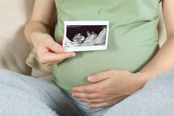 Pregnant woman with ultrasound picture of baby, closeup - Photo, image