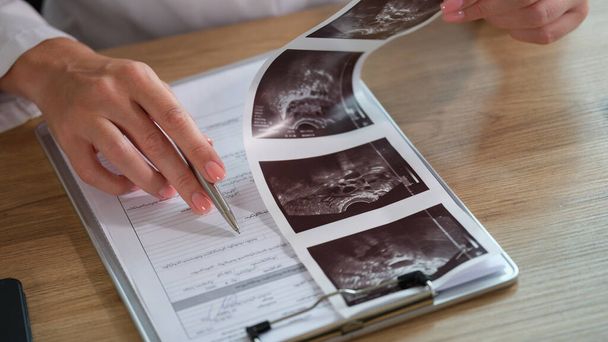 Close-up of doctor filling out medical paperwork. Ultrasound scan results and doctors hands with pen on table. - Foto, Imagen