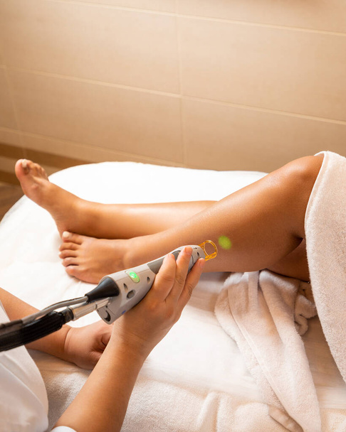 Close-up van ontharing procedure op benen in salon. Laserepilatie op mooie vrouwelijke benen in schoonheidskliniek - Foto, afbeelding