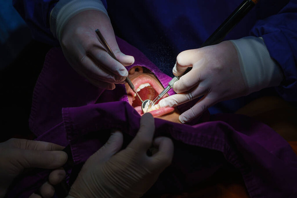 doctor limpiando los dientes paciente con herramienta ultrasónica. Eliminación de sarro y placa, prevención de la paradoja de las enfermedades dentales. - Foto, Imagen