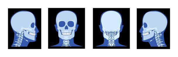 Σετ ακτινογραφίας κεφαλής και τραχήλου Σκελετός Ανθρώπινο σώμα Ενήλικο οστούν τρωκτικό πρόσθια όψη πλάτης. 3D ρεαλιστική επίπεδη μπλε έννοια Διάνυσμα απεικόνιση της ιατρικής ανατομίας που απομονώνονται σε μαύρο φόντο - Διάνυσμα, εικόνα