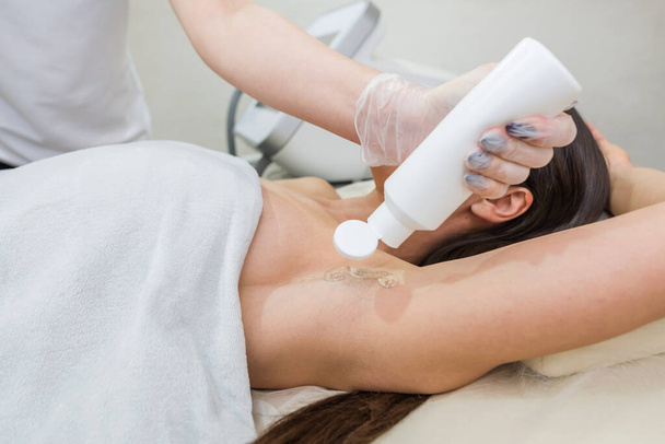 Kosmetolog nanáší speciální průhledný gel na pokožku podpaží. Fáze přípravy gelu na kůži v podpaží pro laserové odstranění chloupků. - Fotografie, Obrázek