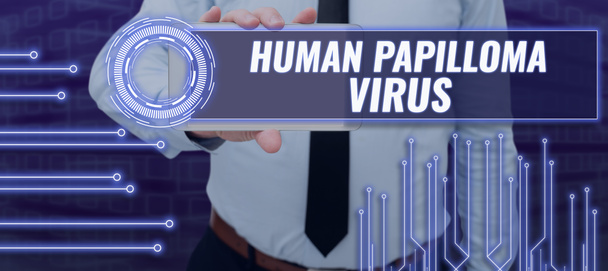 Tekst bijschrift presenteren Human Papilloma Virus, Woord voor de meest voorkomende seksueel overdraagbare infectie ziekte - Foto, afbeelding