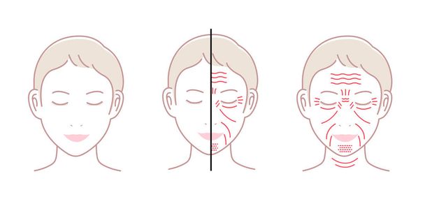 Conjunto de ilustración de vectores de arrugas faciales (cara femenina) / sin texto - Vector, imagen