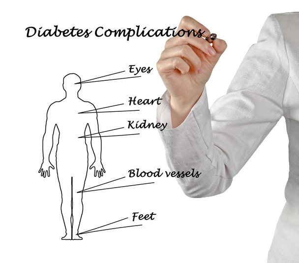  diabetes complications - Photo, Image