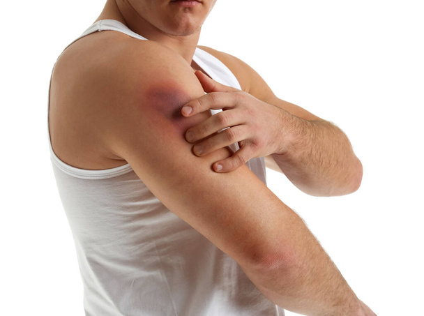 Man with bruise on shoulder against white background - Photo, Image