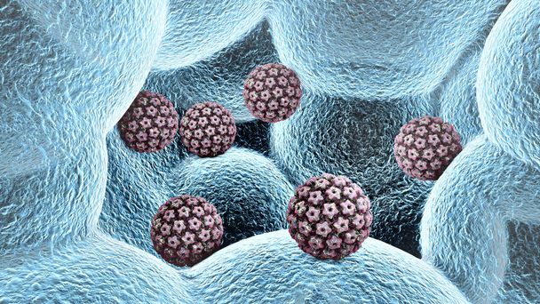 Λοίμωξη από ιό των ανθρώπινων θηλωμάτων. Του ιού. Ο HPV είναι η πιο κοινή σεξουαλικά μεταδιδόμενο νόσημα σε παγκόσμιο επίπεδο. HPV λοίμωξη που προκαλείται από ιό των ανθρώπινων θηλωμάτων, έναν ιό Dna από την οικογένεια των θηλωμάτων, 3d rendering - Φωτογραφία, εικόνα
