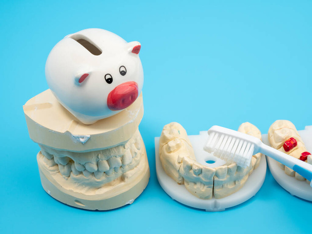 Dişçi kalıpları ve mavi arka planda bir kumbara. Dişlerinin alçı modeli. Yakın plan.. - Fotoğraf, Görsel