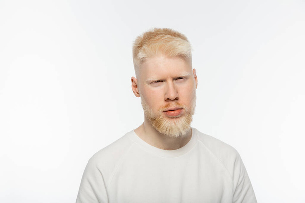 γενειοφόρος και σοβαρός λευκοπαθικός άνδρας με t-shirt κοιτάζοντας την κάμερα που απομονώνεται σε λευκό  - Φωτογραφία, εικόνα