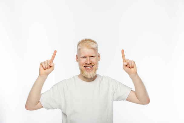 cheerful albino man in t-shirt pointing with fingers on white background - Zdjęcie, obraz